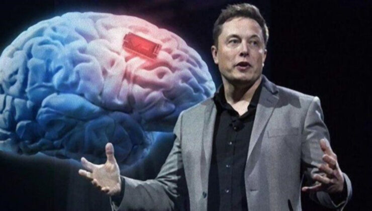 Elon Musk, insan beynine çip takmak için ortak arıyor